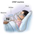 CPAP-Machine-on-Rent-des
