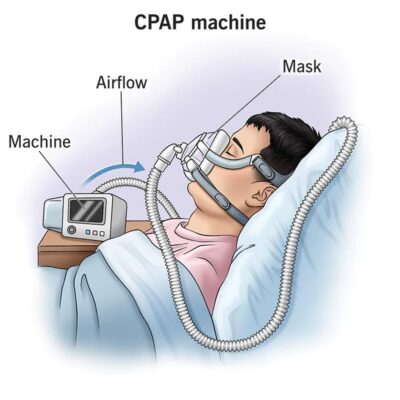 CPAP-Machine-on-Rent-des